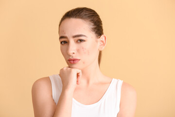 Young woman with acne problem on color background