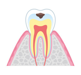 Tooth cross section_4