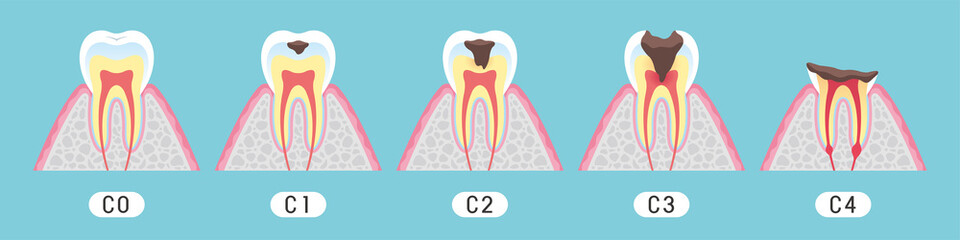 Tooth cross section_11