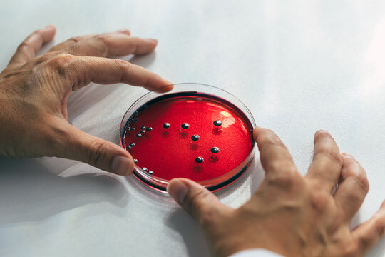 Woman examining petri dishes in the lab