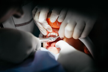 Child at dentist with conscious sedation