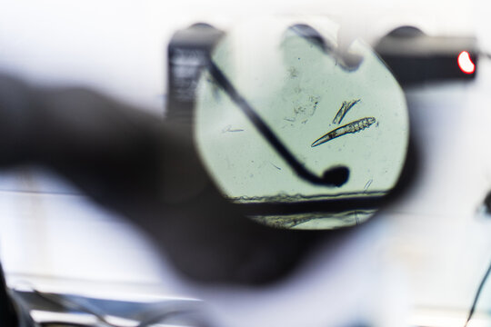 Top view of hair with small parasites placed under lens of modern microscope in laboratory