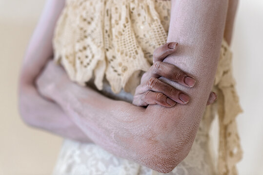 Closeup of model's crossed hands