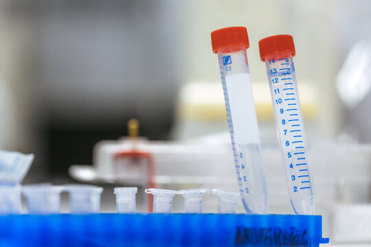 Two tubes for analysis