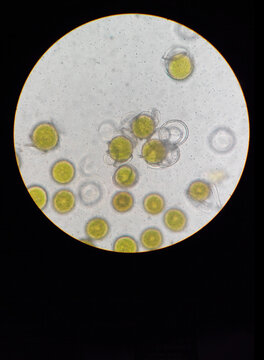 Microscope photography of different organic tissues made with a phone camera