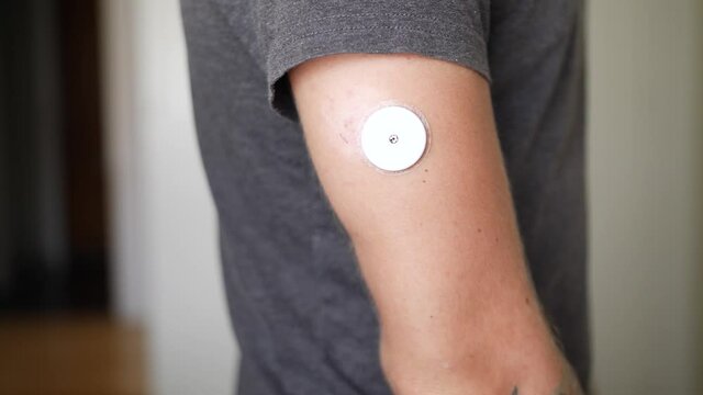 Close up shot of an arm of a young man with diabetes checks his blood glucose levels in his home with his smartphone and glucose reading sensor on his arm.