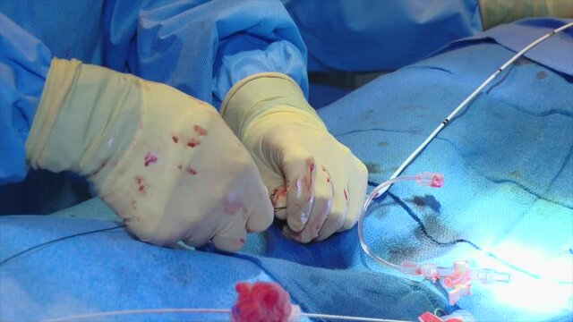 Cath lab operation general operating room