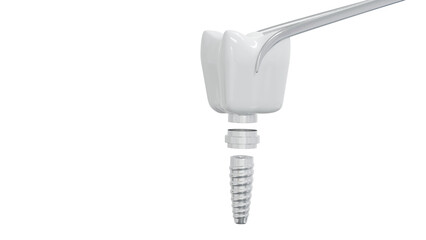 Dental care and dental implants isolated on white background. clipping part. 3d render.