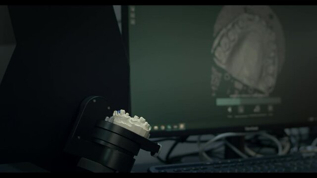 3D scanning of a plaster cast of the jaw. Modern dental technology. Ultraviolet rays travel through the teeth. 3d model on the screen