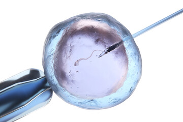 Artificial insemination or in vitro fertilization - 381193230