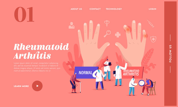 Rheumatoid Arthritis Landing Page Template. Tiny Doctor Characters Examine Huge Hand with Joints Disease, Arms Illness