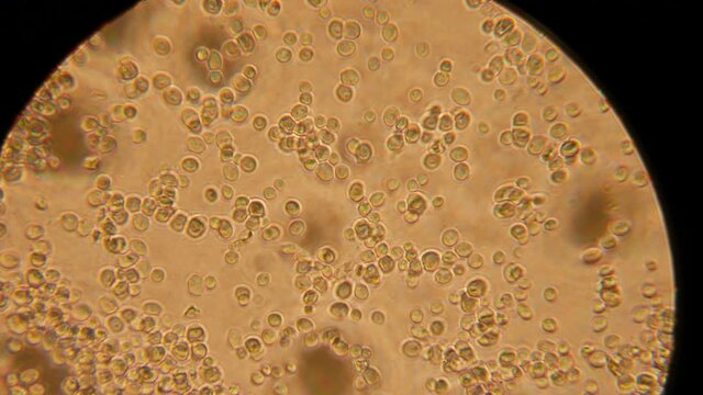 Biofuel production. Fermentation of Ethanol. Live bacteria under a microscope.