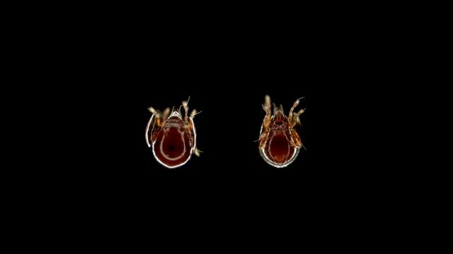 mite (acari) Oribatida under microscope. Families Parakalummidae, order Sarcoptiformes. They have a hard shell for protection from predators. Sample found at Murmansk Region