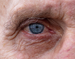 Fototapeta premium The old man's blue eye.