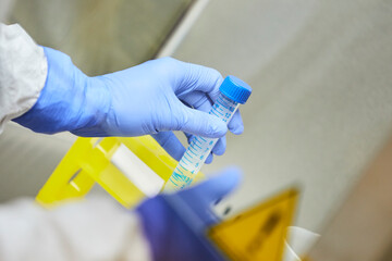 Covid-19 Vaccine Test in the Lab.