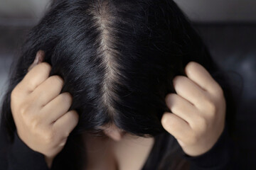 A woman has hair problems, she has hair loss.