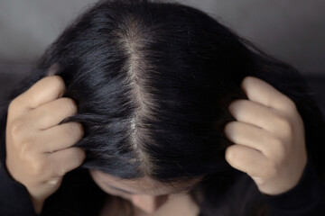 Naklejka premium A woman has hair problems, she has hair loss.