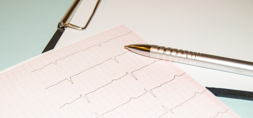 Heart rate result graph paper document electrocardiogram and pen on it, analysis of medical research results