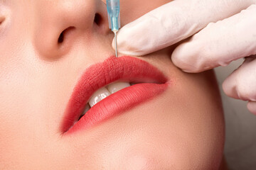 Woman getting cosmetic injection of botulinum to lips. Lip augmentation procedure in a beauty...