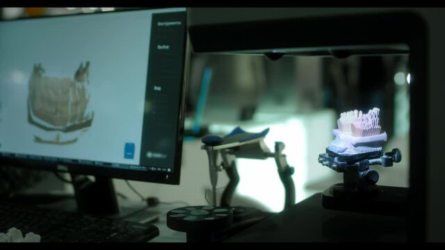 3D scanning of a plaster cast of the jaw. Modern dental technology. Ultraviolet rays travel through the teeth. 3d model on the screen