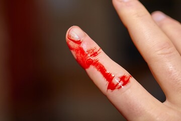 Finger cut and bleeding skin index finger on hand, in need of a plaster