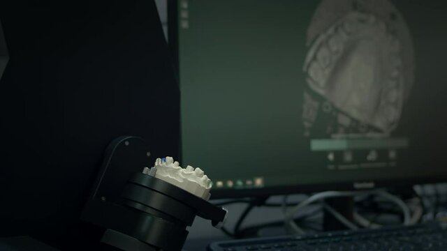 3D scanning of a plaster cast of the jaw. Modern dental technology. Ultraviolet rays travel through the teeth. 3d model on the screen