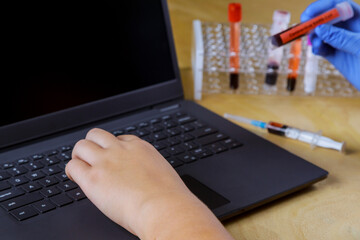 Doctor works with laptop medical equipment blood sample tube from rack with analysis in the lab...
