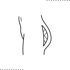 Body shape correction, buttock augmentation, Brazilian Butt Lift  vector icon in outlines