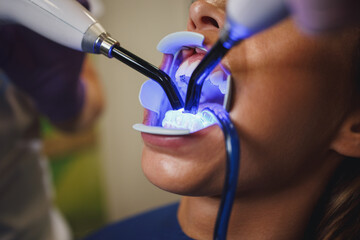 For The Most Beautiful Teeth