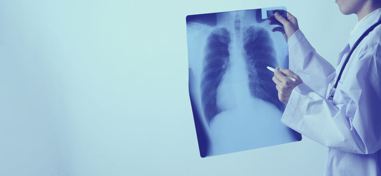 Middle aged of asian woman doctor standing and holding a x-ray film or radiography. she looking for unnormal or disease on lungs which illness from coronavirus pandemic.