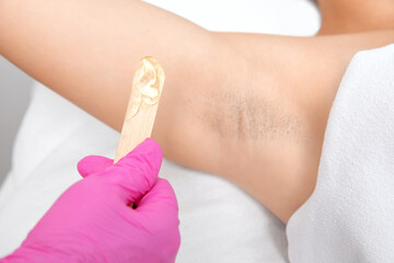 The cosmetologist does laser hair removal on the armpits, she applies the gel to the skin. Laser hair removal and cosmetology. The concept of cosmetology and spa.