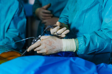 Medical instruments in surgeon's hands. Operating process in hospital. Doctors performing operation with surgery tools.