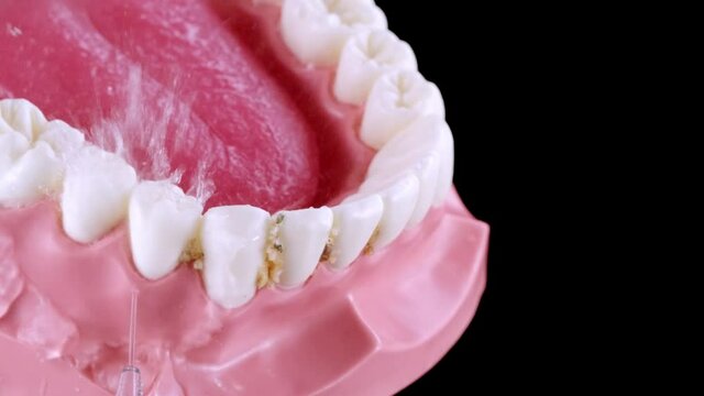 Fake jaw cleaning food remains with water flosser. Dirty teeth, corn flakes, stucked food. Oral irrigator washing teeth on black background in slow motion. 4k 120 fps