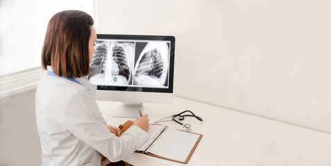 Young woman radiologist doctor analysis pulmonary  x-ray and  make a medical description of xray in notebook