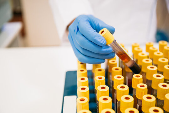 Crop person in latex gloves taking blood sample from tray while working in modern laboratory