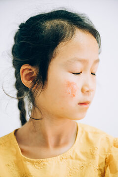 Portrait of school girl with scratches on face