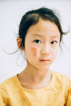 Portrait of school girl with scratches on face