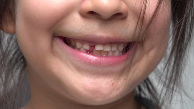 closeup of a little girl's toothless smile as she sticks her tongue out between them and smiling