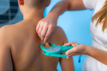 Subcutaneous body fat measurement in children, using a calliper in anthropometry