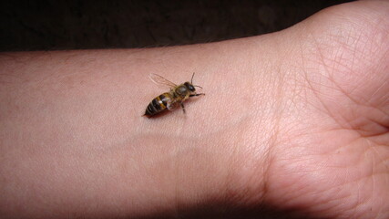 bee : apis mellifera treatment by honey bee sting closeup honey bee stinging a hand close up bee worker insects, insect, animal, wildlife, wild nature, forest, woods, garden beauty of pollination