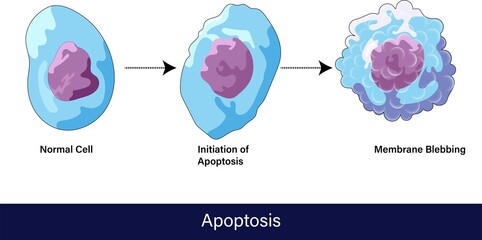 Stages of apoptosis from normal cell to final stage of formation of membrane blebbing vector