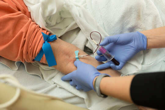 Blood Draw