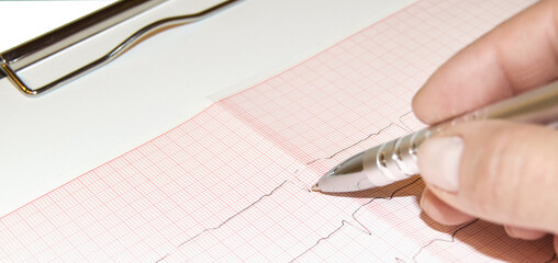 healthcare and medical concept - female doctor hands studies cardiogram holding pen