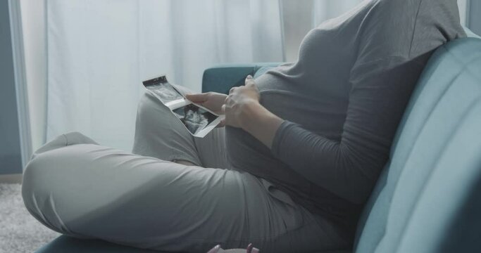Pregnant mother watching a sonogram of her baby