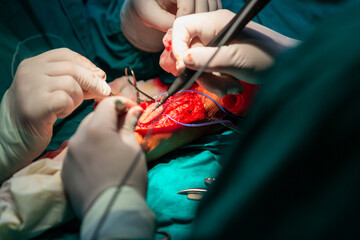 Open hand radial artery surgery in hospital