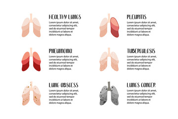 Lungs diseases. Pneumonia, lung abscess, pleuritis, tuberculosis, cancer. Pulmonology. Vector flat illustration. Perfect for flyer, medical brochure, banner, landing page, website