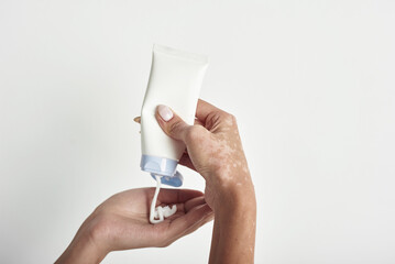 Woman pouring body care cream from bottle into her hand with vitiligo. Take care of your body skin. Health and beauty concept