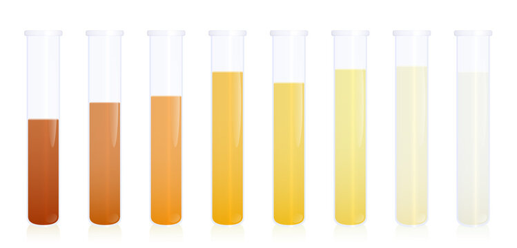 Urine samples, specimen test tubes with different colored urine - gradation from dark orange to yellow and clear liquid. Indicator of dehydration levels. Medical vector illustration on white.
