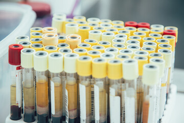 Various marked test tubes with substances in them