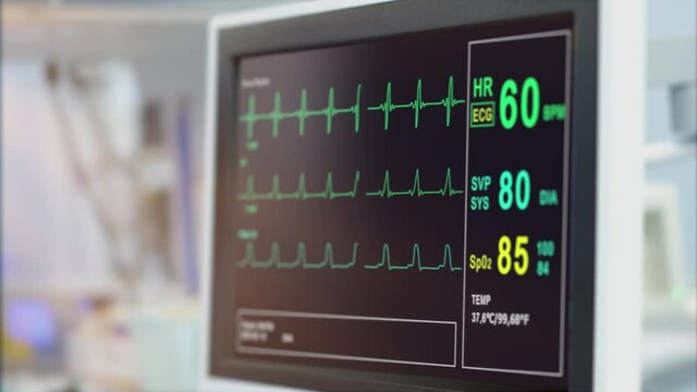Heart rate monitor in hospital theater. Medical vital signs monitor instrument in a hospital on anesthesia surgery monitor. ECG. Patient heartbeat at the screen